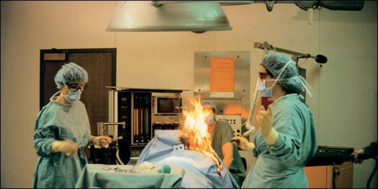 Gases emitidos pela paciente causaram as chamas (imagem ilustrativa). Foto: Reprodução Internet