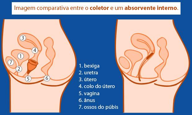 Imagem da diferença de um coletor menstrual e de um absorvente interno no corpo da mulher (Ilustração: Guilherme Castro / NE10)