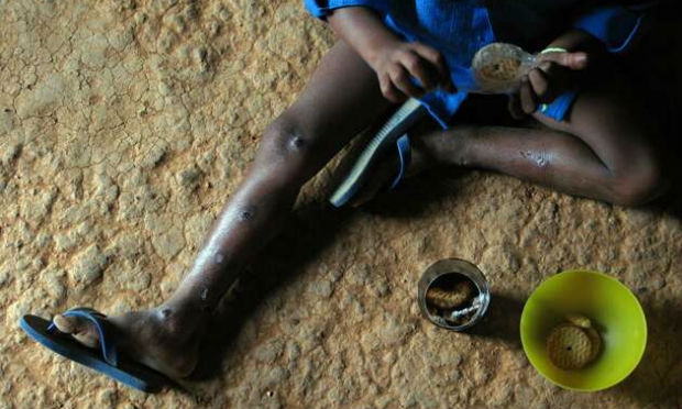 No caso do Brasil, a FAO cita o programa Fome Zero, que tem a participação de 19 ministérios e que ajudou a reduzir a pobreza de 24,3% a 8,4% entre 2001 e 2012 / Foto: Arnaldo Carvalho/JC Imagem