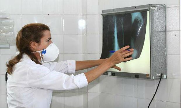 O tempo de análise para diagnosticar a tuberculose passou de oito horas para apenas dois minutos / Foto: Agecom Bahia